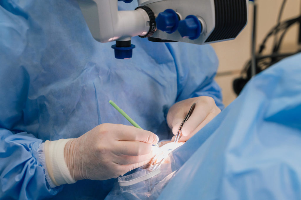 2 operatia de cataracta 1