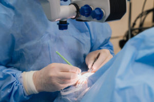 2 operatia de cataracta 1