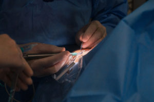 8 Operatia de cataracta